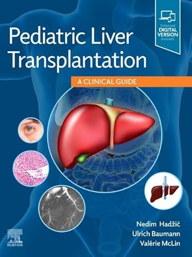 Pediatric Liver Transplantation: A Clinical Guide von Elsevier